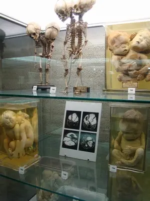 Museum Vrolik